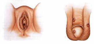 Jual Obat Sipilis De Nature Pengiriman ke Pulau Taliabu